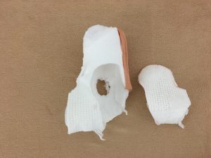 足首のプライトン