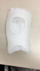 膝の前面プライトン